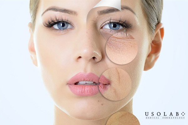 uống gì cho da đẹp hồng hào