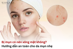bị mụn có nên xông mặt không