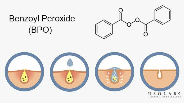 Thành phần cần chú ý khi dùng nhiều loại kem dưỡng