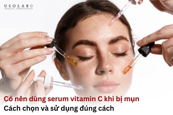 có nên dùng serum vitamin c khi bị mụn