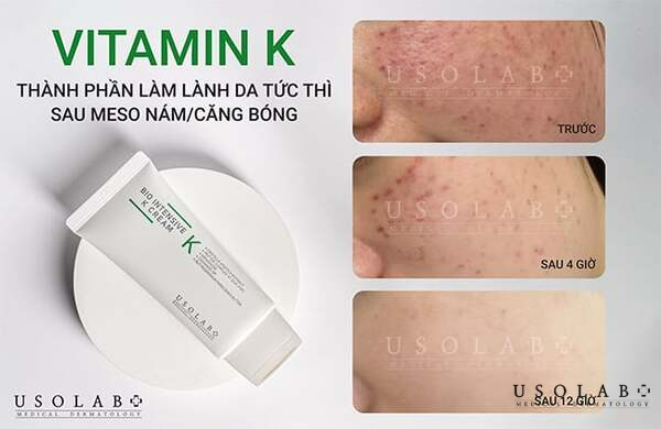 Bio Intensive K Cream