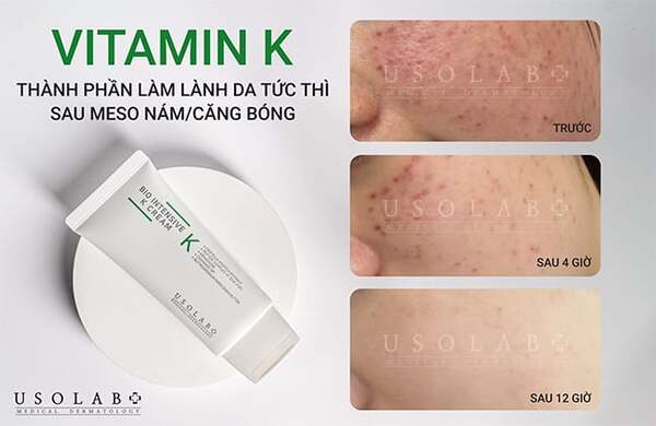 Kem dưỡng phục hồi tức thì Bio Intensive K Cream Kem dưỡng phục hồi tức thì Bio Intensive K Cream