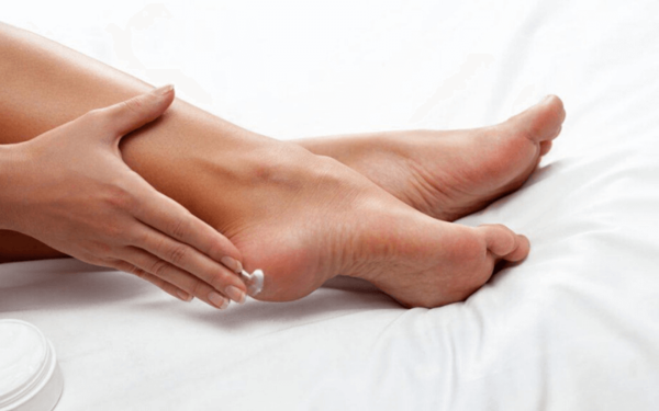 Da chân chai sần, dày cứng