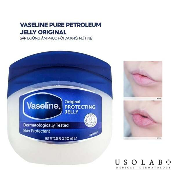Kem dưỡng ẩm, trị nẻ dạng sáp Vaseline Pure Petrolium Jelly