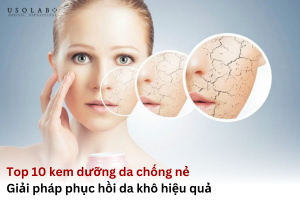 kem dưỡng da chống nẻ