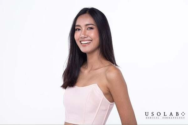 Da ngăm đen vì sao khó trắng và cần dưỡng theo cơ chế nào?