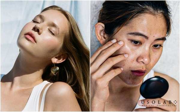 So sánh kem dưỡng trắng da vs serum sáng da