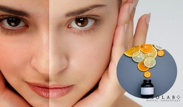 Cách dùng kem dưỡng vitamin C