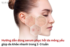serum phục hồi da mỏng yếu