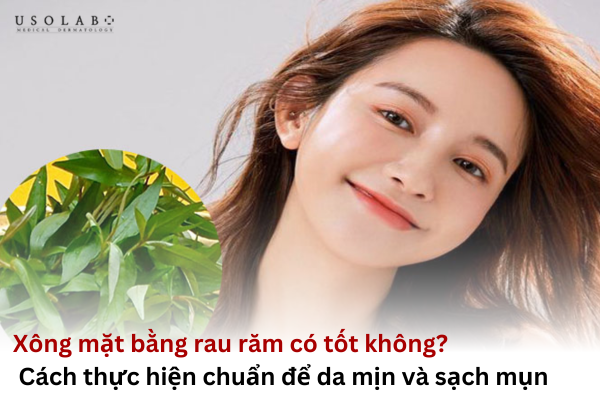 xông mặt bằng rau răm