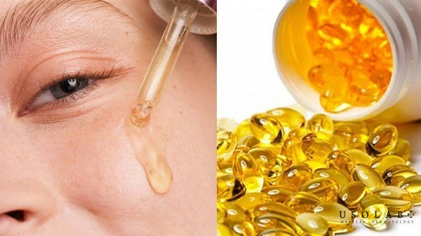 Xông mặt bằng vitamin E