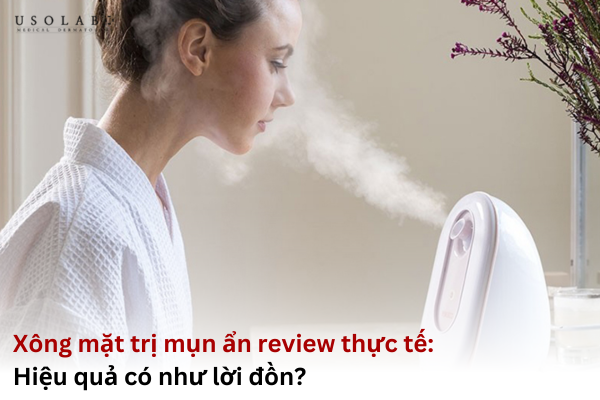 xông mặt trị mụn ẩn review