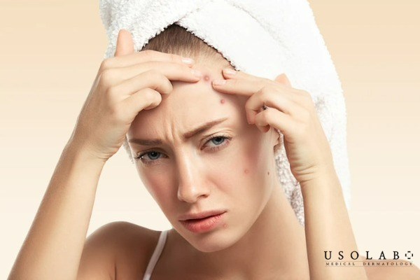 xông mặt xong nên làm gì