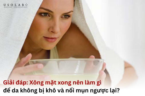 xông mặt xong nên làm gì