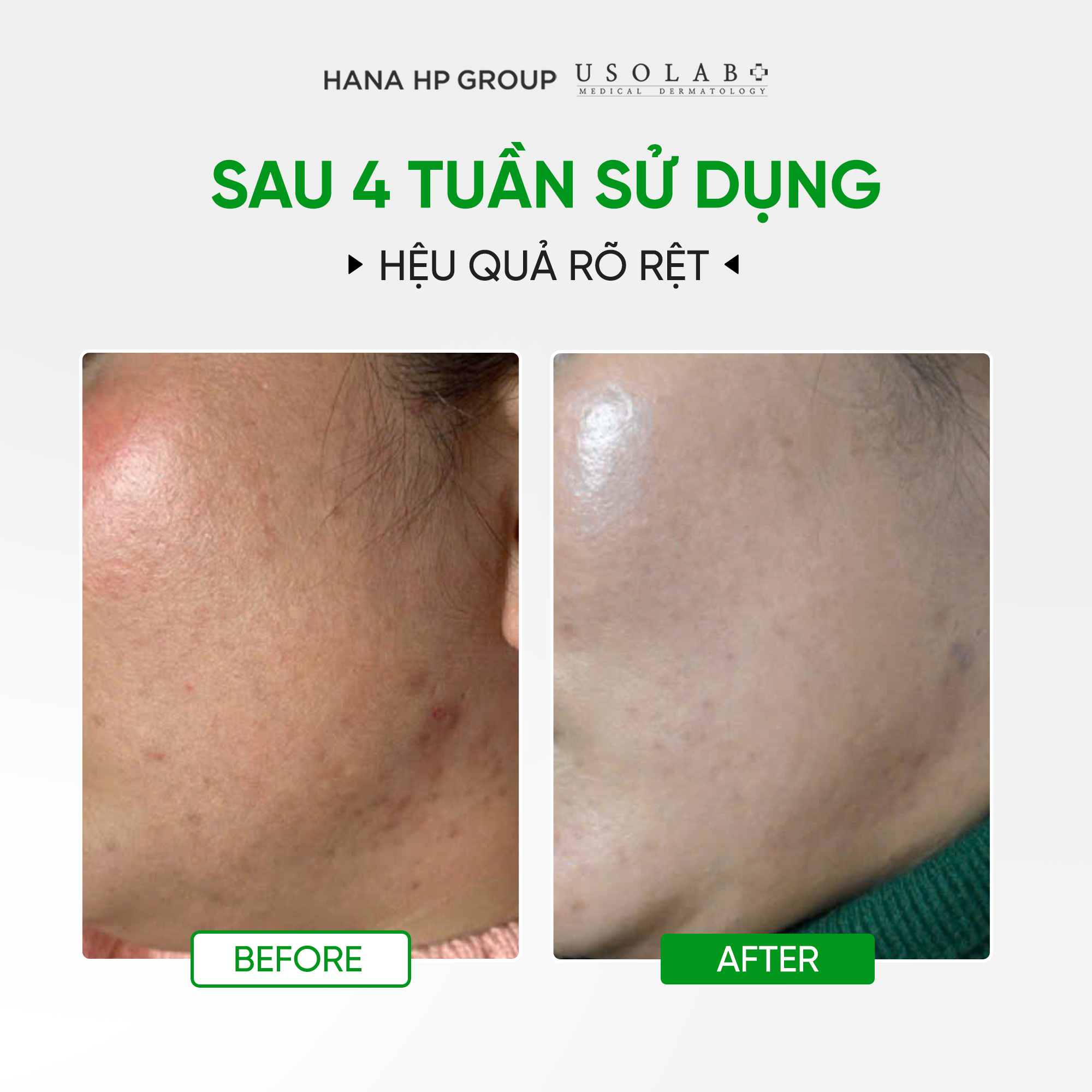 Vitamin K Cream Usolab