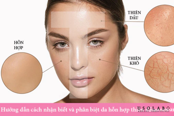 Các sản phẩm này thường chứa hyaluronic acid, tea tree oil, centella asiatica