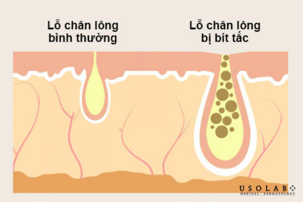 Chất làm dịu như centella asiatica, madecassoside, panthenol hay ceramide