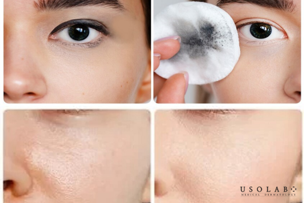 Tẩy trang giúp loại bỏ những bụi bẩn, dầu thừa trên da suốt 1 ngày dài