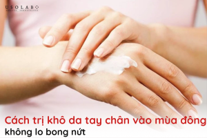 cách trị khô da tay chân vào mùa đông