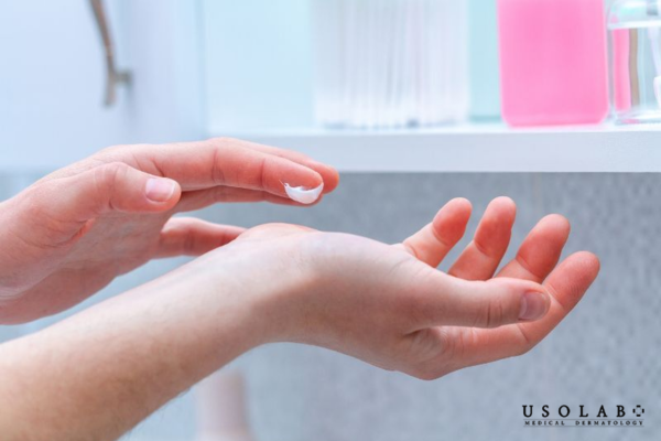 Dưỡng ẩm da tay chân mùa đông sao cho giữ ẩm lâu, không bết dính Dưỡng ẩm da tay chân mùa đông sao cho giữ ẩm lâu, không bết dính