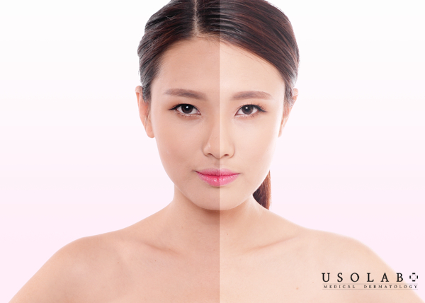 Là những hợp chất có khả năng làm giảm sự xuất hiện của sắc tố melanin trên da Là những hợp chất có khả năng làm giảm sự xuất hiện của sắc tố melanin trên da