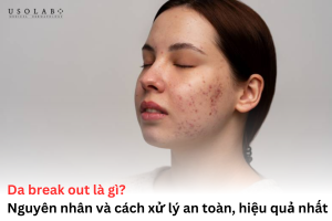 da break out là gì