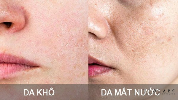 Da khô do thiếu nước và độ ẩm