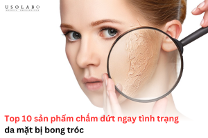 da mặt bị bong tróc