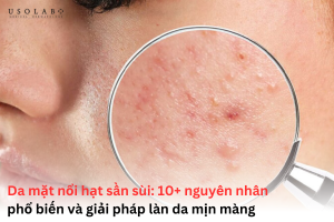 da mặt nổi hạt sần sùi