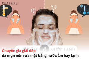 da mụn nên rửa mặt bằng nước ấm hay lạnh