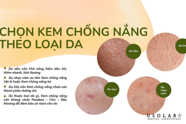 Cách chọn kem chống nắng dưỡng ẩm theo từng loại da Cách chọn kem chống nắng dưỡng ẩm theo từng loại da