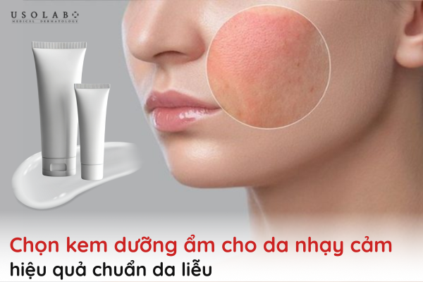 kem dưỡng ẩm cho da nhạy cảm
