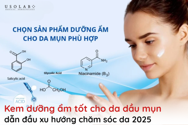 kem dưỡng ẩm tốt cho da dầu mụn