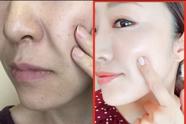 Người có da sạm, thâm, không đều màu