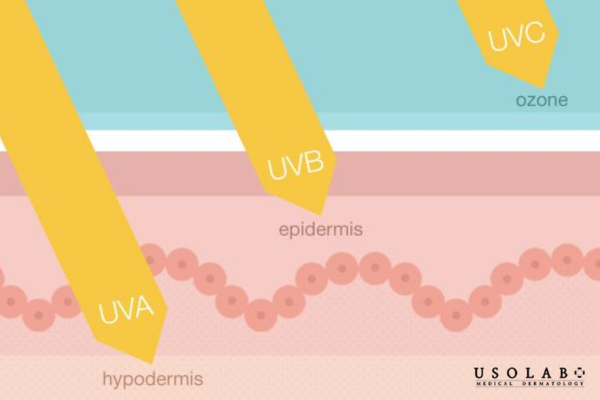 Mùa đông vẫn cần bôi kem chống nắng để bảo vệ da một cách toàn diện Mùa đông vẫn cần bôi kem chống nắng để bảo vệ da một cách toàn diện