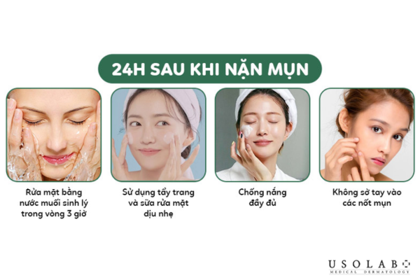 Quy trình chăm sóc da sau khi nặn mụn Quy trình chăm sóc da sau khi nặn mụn