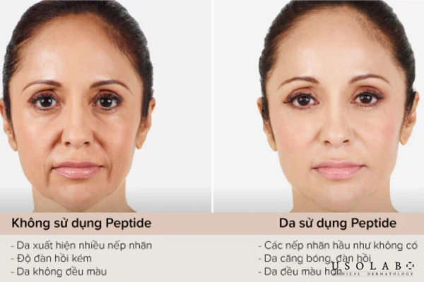 Peptide có tác dụng gì Peptide có tác dụng gì