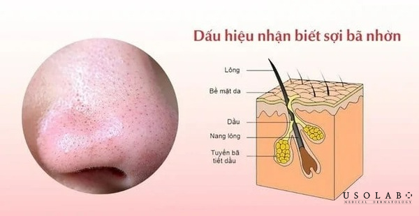 Vì đây là khu vực có mật độ tuyến dầu cao và hoạt động mạnh