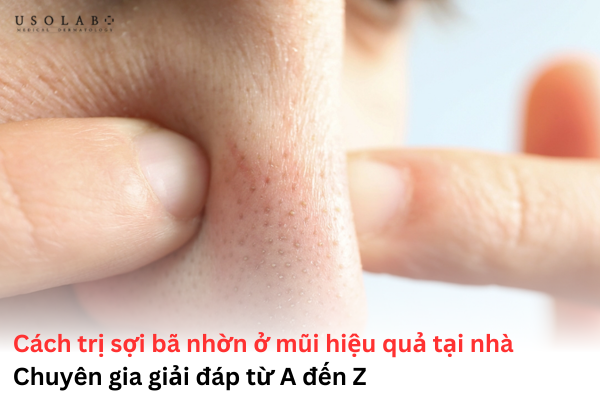 sợi bã nhờn ở mũi