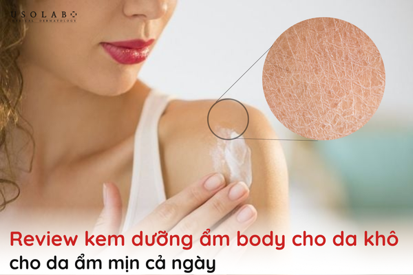 review kem dưỡng ẩm body cho da khô