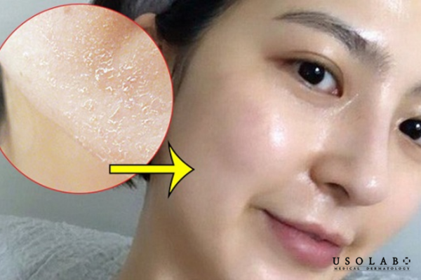 Khác gì so với sữa rửa mặt cho da thường hoặc da dầu