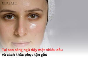 tại sao sáng ngủ dậy mặt nhiều dầu