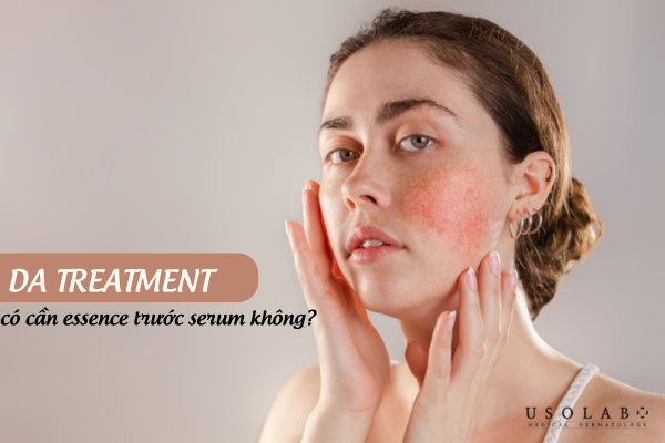 Da treatment có cần essence trước serum không
