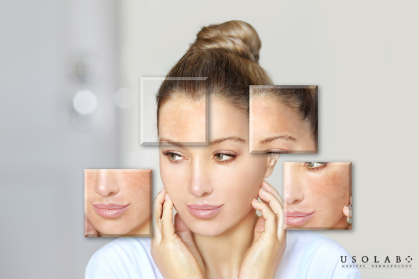 Vitamin B3 serum phù hợp với hầu hết các loại da nhờ đặc tính ổn định, an toàn