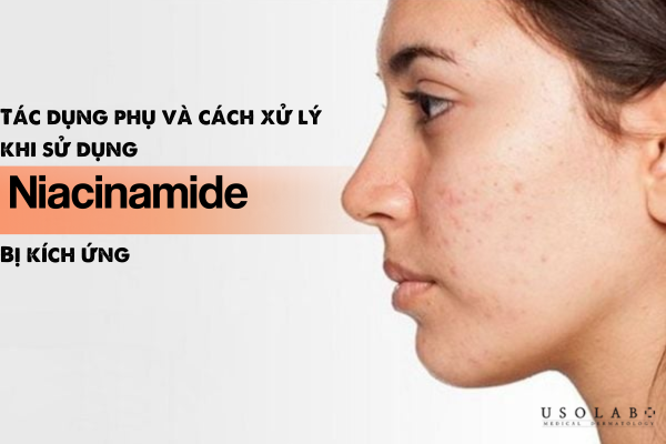 Tác dụng phụ có thể gặp phải khi sử dụng Vitamin B3 sai cách