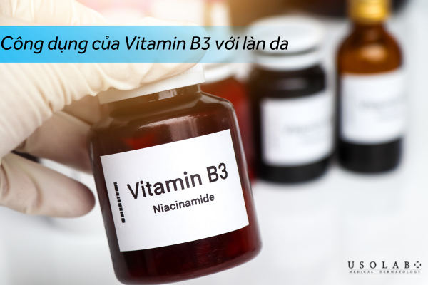 Vitamin B3 serum là tinh chất chăm sóc da chứa nồng độ cao Niacinamide