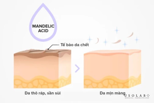 Mandelic acid hoạt động qua cơ chế tẩy tế bào chết hóa học nhẹ nhàng Mandelic acid hoạt động qua cơ chế tẩy tế bào chết hóa học nhẹ nhàng