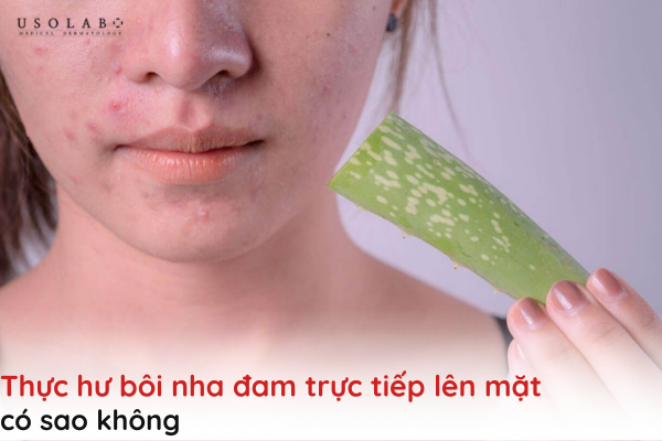 bôi nha đam trực tiếp lên mặt có sao không