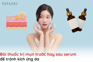 bôi thuốc trị mụn trước hay sau serum