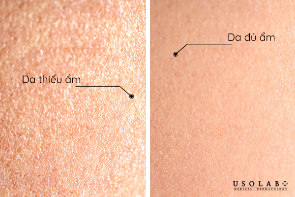 Serum giúp cấp ẩm cho da hiệu quả, giúp da luôn căng bóng, sáng khoẻ